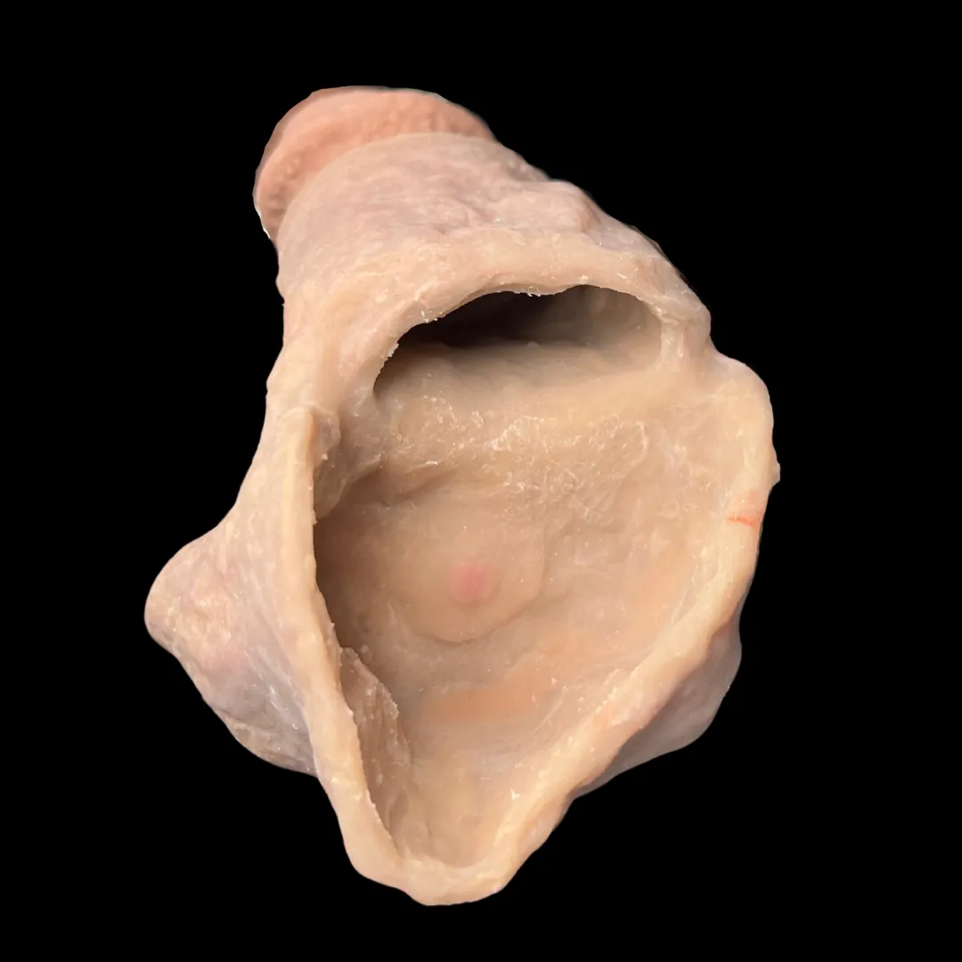 The X-1000™ (Closed Tip)