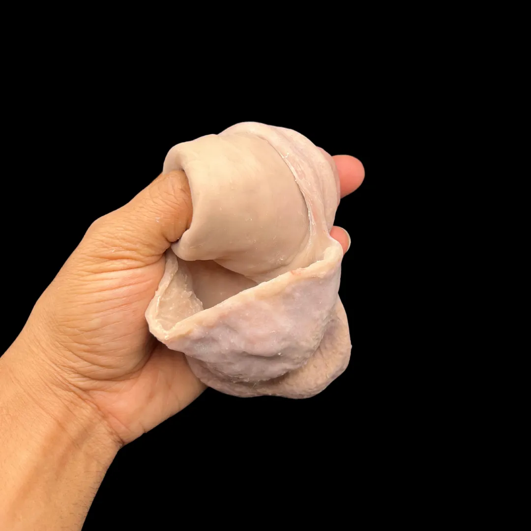 The X-1000™ (Closed Tip)
