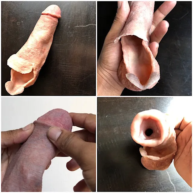 The X-1000™ (Closed Tip)